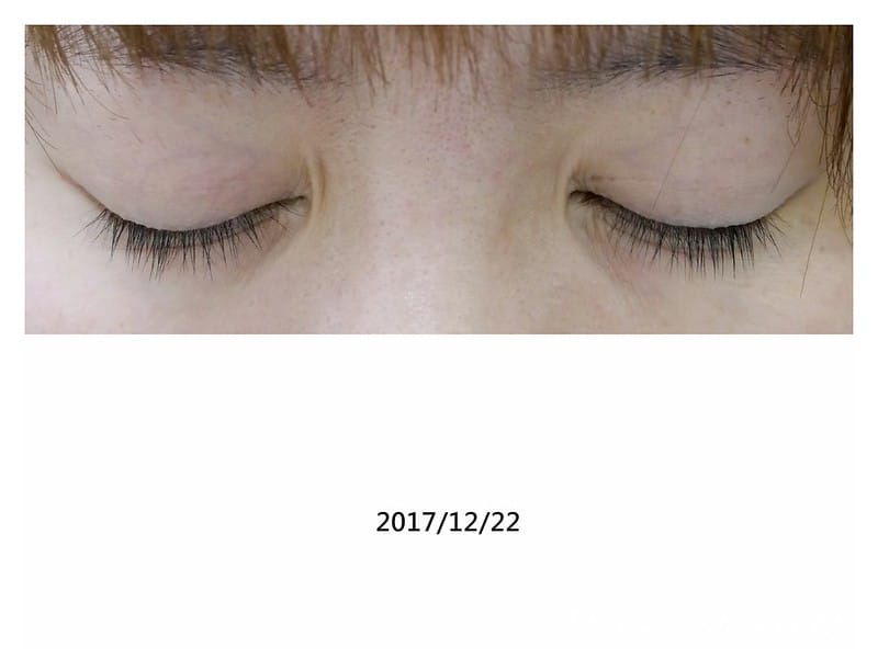 0003