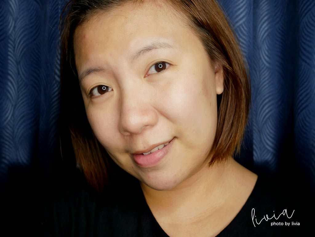 skinlife6