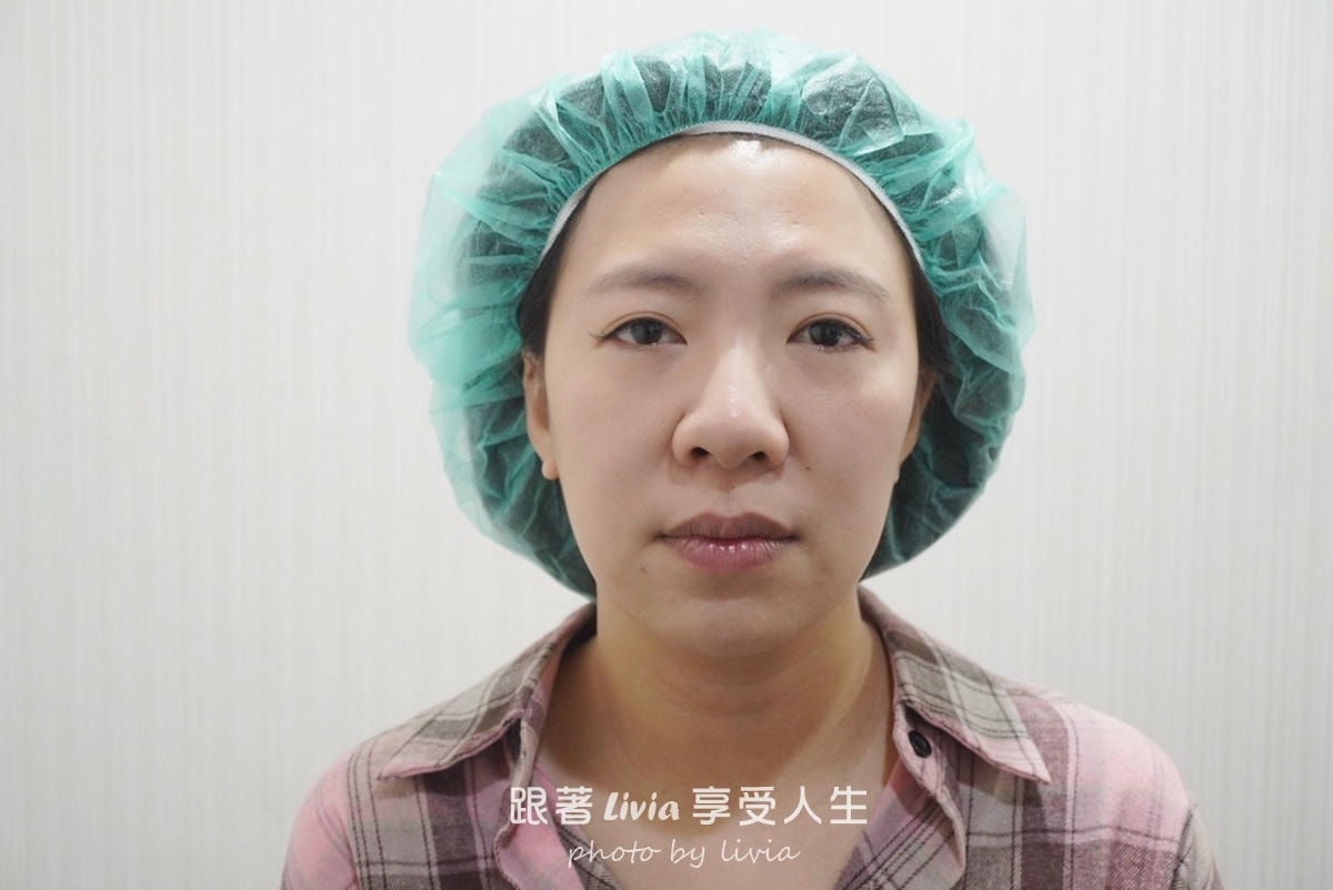 把疲態收一收的小魔法|永欣診所臉蛋保養記!皇后電波、渦旋音波、肉毒 - 第7張圖 把疲態收一收的小魔法|永欣診所臉蛋保養記!皇后電波、渦旋音波、肉毒
