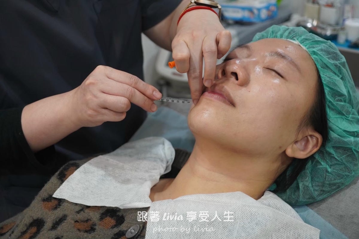 把疲態收一收的小魔法|永欣診所臉蛋保養記!皇后電波、渦旋音波、肉毒 - 第9張圖 把疲態收一收的小魔法|永欣診所臉蛋保養記!皇后電波、渦旋音波、肉毒