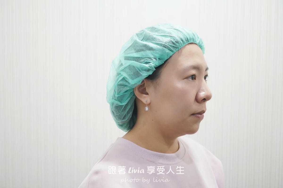 把疲態收一收的小魔法|永欣診所臉蛋保養記!皇后電波、渦旋音波、肉毒 - 第5張圖 把疲態收一收的小魔法|永欣診所臉蛋保養記!皇后電波、渦旋音波、肉毒