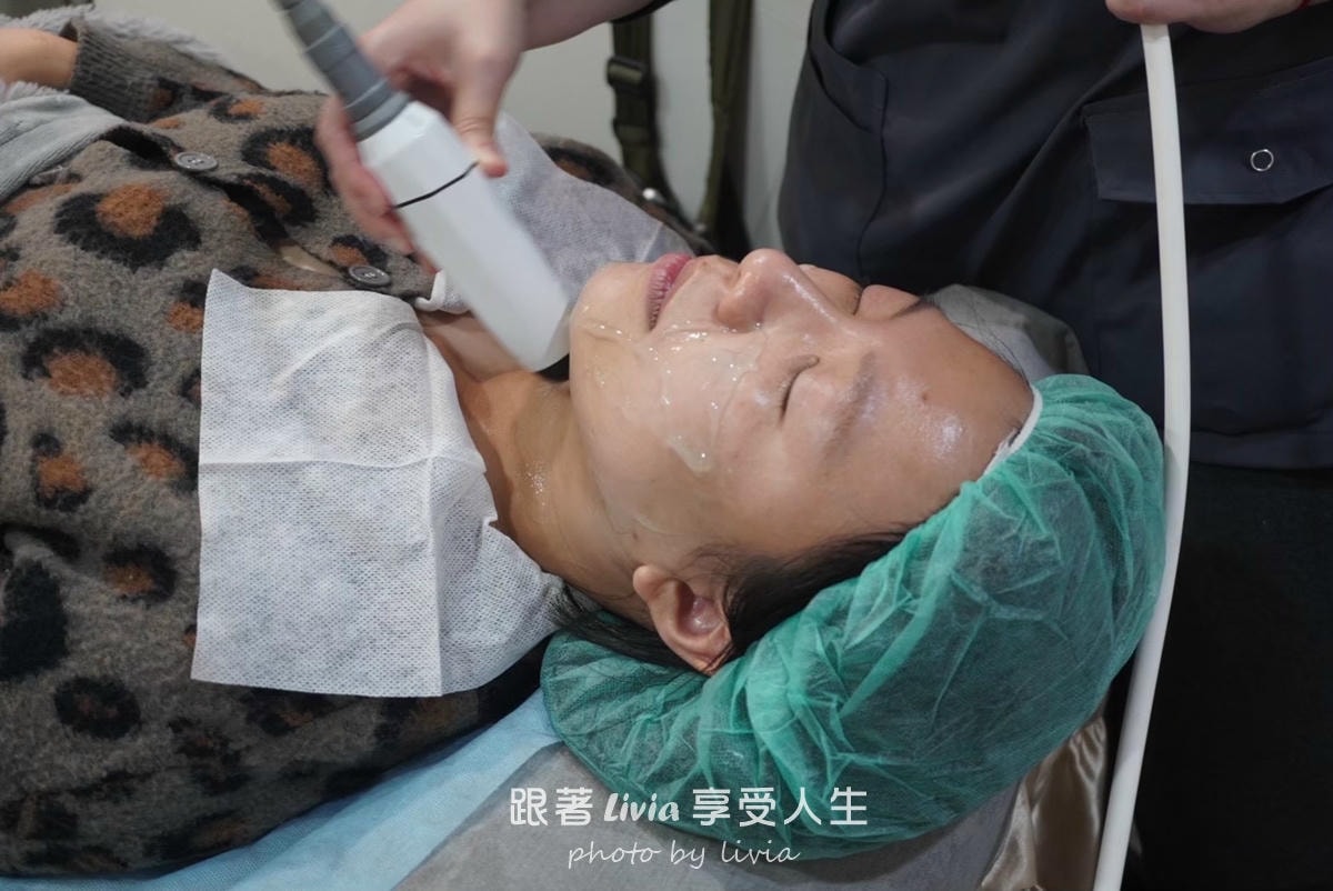 把疲態收一收的小魔法|永欣診所臉蛋保養記!皇后電波、渦旋音波、肉毒 - 第6張圖 把疲態收一收的小魔法|永欣診所臉蛋保養記!皇后電波、渦旋音波、肉毒
