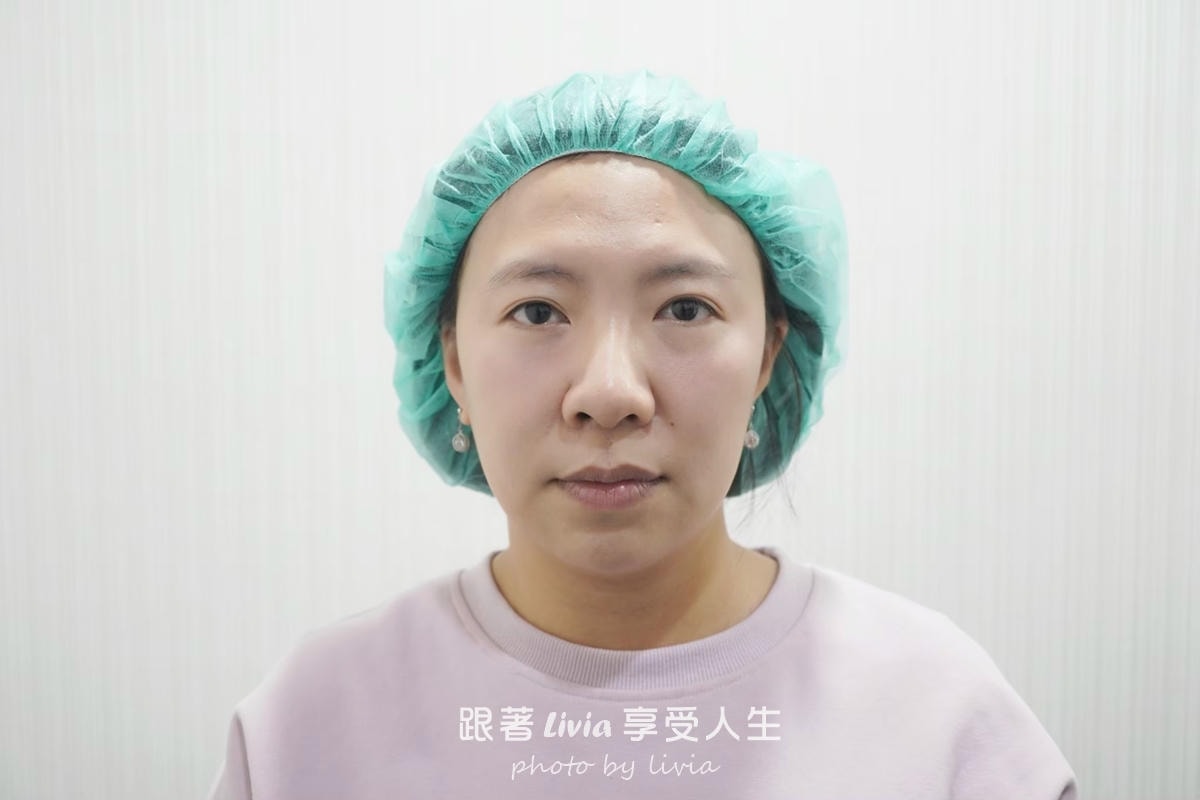 把疲態收一收的小魔法|永欣診所臉蛋保養記!皇后電波、渦旋音波、肉毒 - 第4張圖 把疲態收一收的小魔法|永欣診所臉蛋保養記!皇后電波、渦旋音波、肉毒