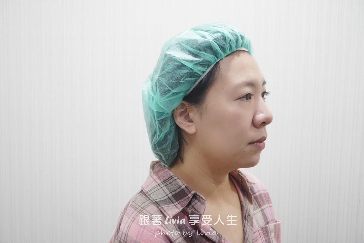 把疲態收一收的小魔法|永欣診所臉蛋保養記!皇后電波、渦旋音波、肉毒 - 第8張圖 把疲態收一收的小魔法|永欣診所臉蛋保養記!皇后電波、渦旋音波、肉毒